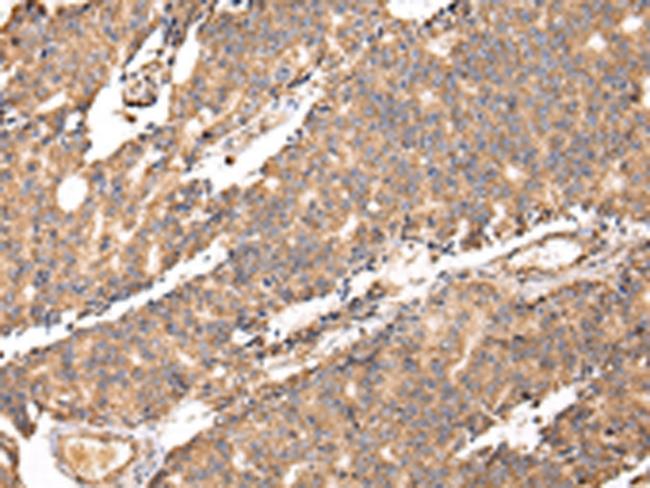 UGGT2 Antibody in Immunohistochemistry (Paraffin) (IHC (P))