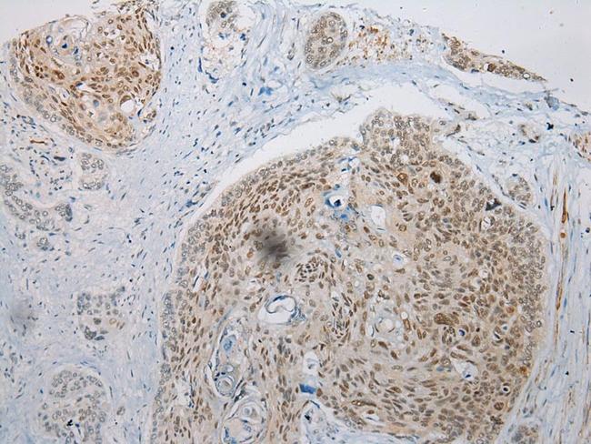 WDR45 Antibody in Immunohistochemistry (Paraffin) (IHC (P))