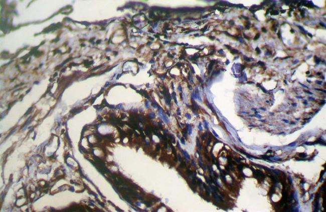 WFDC5 Antibody in Immunohistochemistry (Paraffin) (IHC (P))