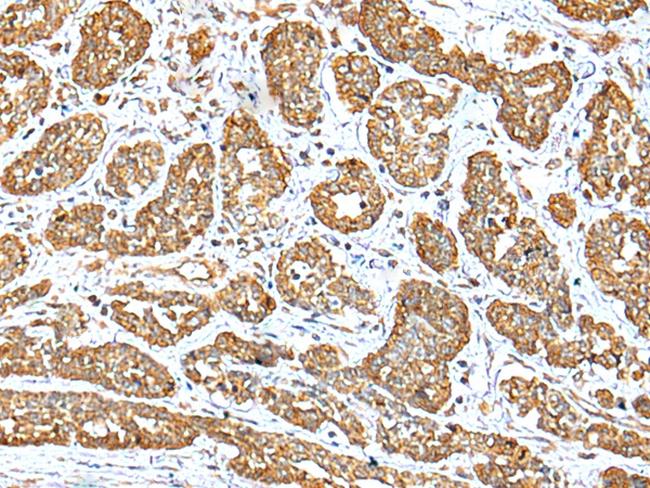 NDUFB10 Antibody in Immunohistochemistry (Paraffin) (IHC (P))