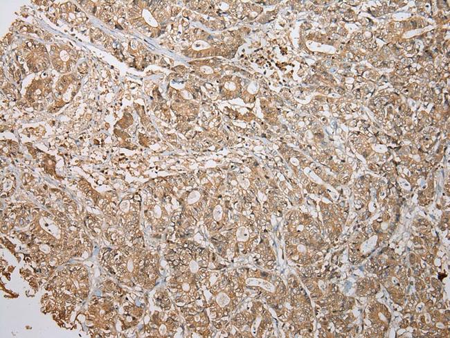 ATXN7L3 Antibody in Immunohistochemistry (Paraffin) (IHC (P))