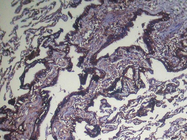 NUDT4 Antibody in Immunohistochemistry (Paraffin) (IHC (P))