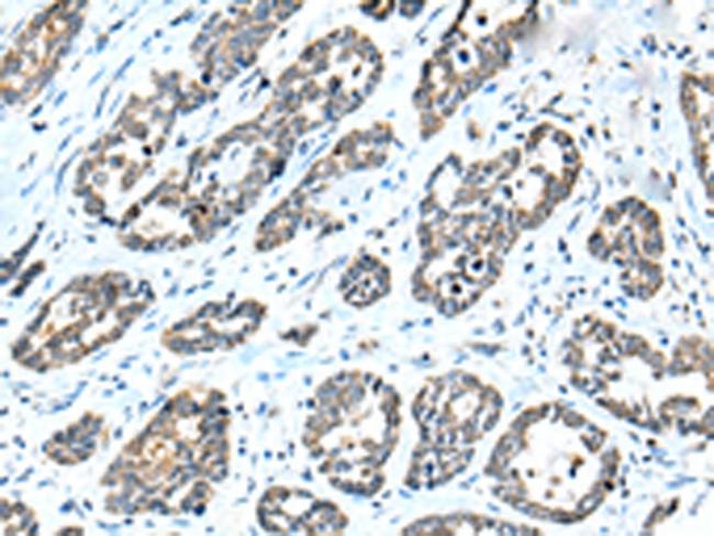 NPL Antibody in Immunohistochemistry (Paraffin) (IHC (P))