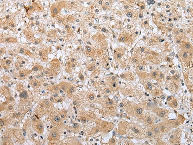 RFK Antibody in Immunohistochemistry (Paraffin) (IHC (P))