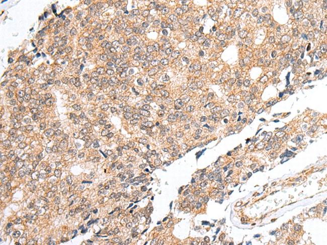 PRELID1 Antibody in Immunohistochemistry (Paraffin) (IHC (P))