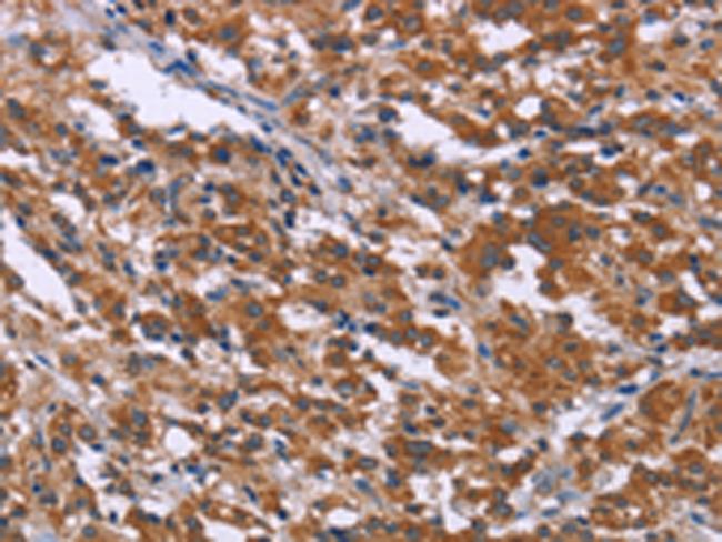 SKI Antibody in Immunohistochemistry (Paraffin) (IHC (P))