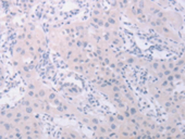 PK2L1 Antibody in Immunohistochemistry (Paraffin) (IHC (P))