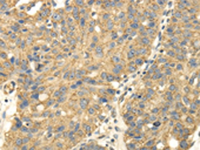 UHRF1BP1 Antibody in Immunohistochemistry (Paraffin) (IHC (P))