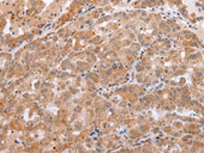 beta-Defensin 1 Antibody in Immunohistochemistry (Paraffin) (IHC (P))