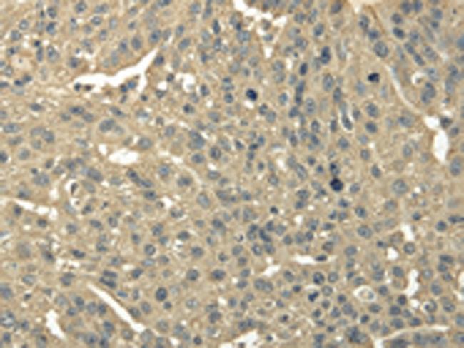 TRIB2 Antibody in Immunohistochemistry (Paraffin) (IHC (P))