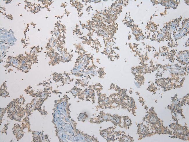 FAM101A Antibody in Immunohistochemistry (Paraffin) (IHC (P))