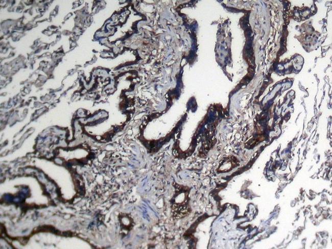 NUDT10 Antibody in Immunohistochemistry (Paraffin) (IHC (P))