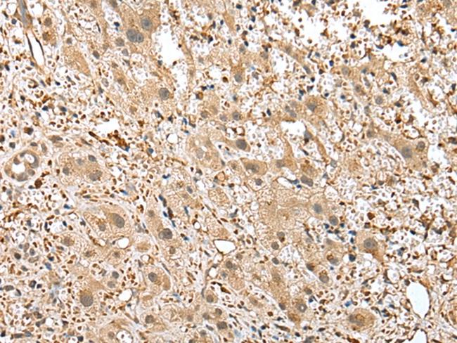 GSTM2 Antibody in Immunohistochemistry (Paraffin) (IHC (P))