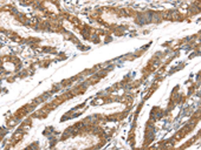 GPD2 Antibody in Immunohistochemistry (Paraffin) (IHC (P))