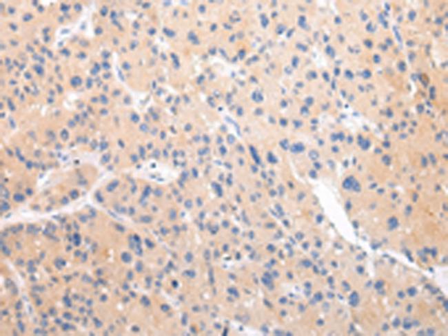 ZNF106 Antibody in Immunohistochemistry (Paraffin) (IHC (P))