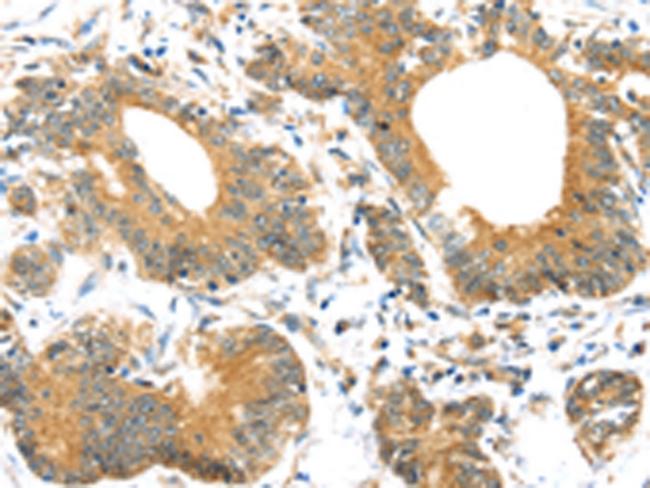 UBTD1 Antibody in Immunohistochemistry (Paraffin) (IHC (P))