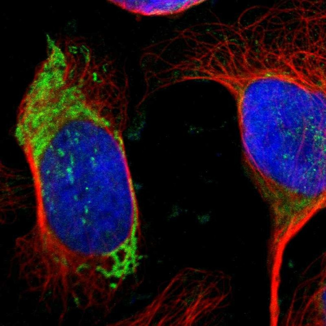 OTC Antibody in Immunocytochemistry (ICC/IF)