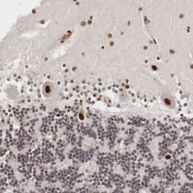 DACH2 Antibody in Immunohistochemistry (Paraffin) (IHC (P))