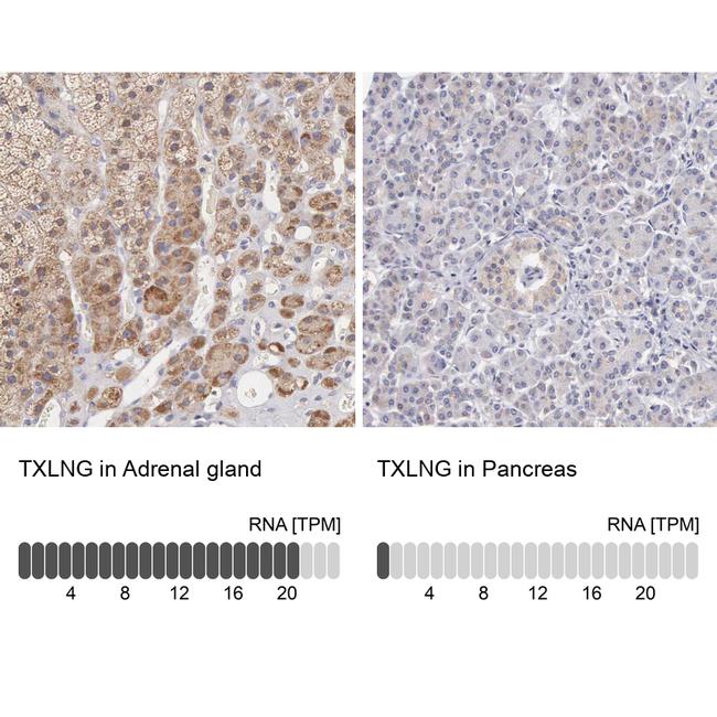 TXLNG Antibody in Immunohistochemistry (IHC)