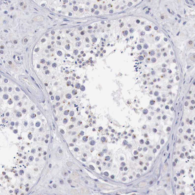 RFP2 Antibody in Immunohistochemistry (Paraffin) (IHC (P))