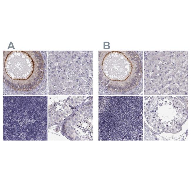 ZNF185 Antibody in Immunohistochemistry (IHC)