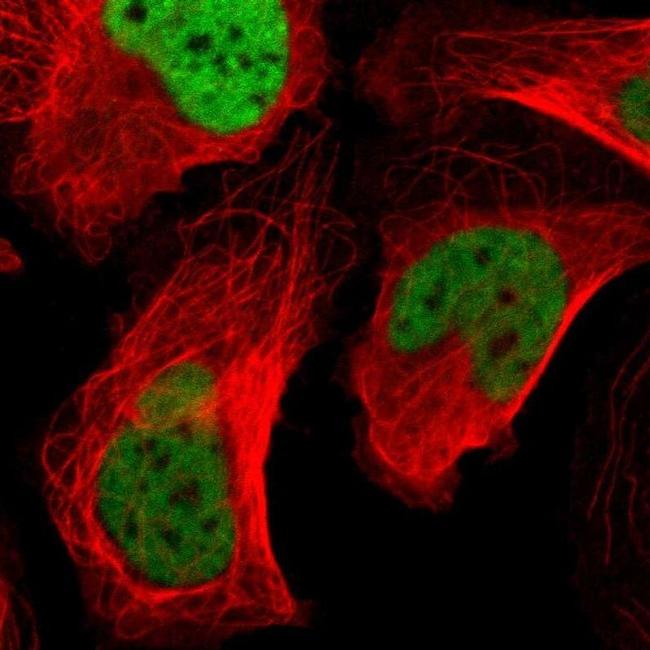 CSTF2 Antibody in Immunocytochemistry (ICC/IF)