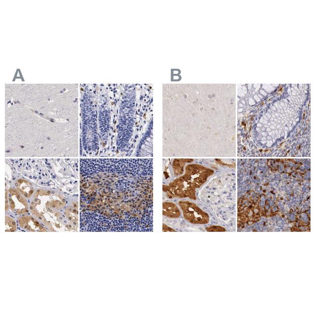 RENBP Antibody in Immunohistochemistry (IHC)