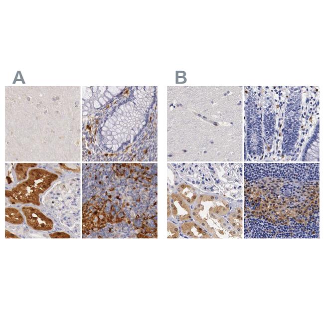 RENBP Antibody in Immunohistochemistry (IHC)