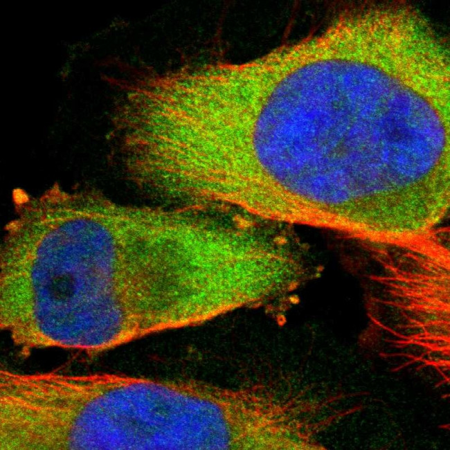 ADSL Antibody in Immunocytochemistry (ICC/IF)