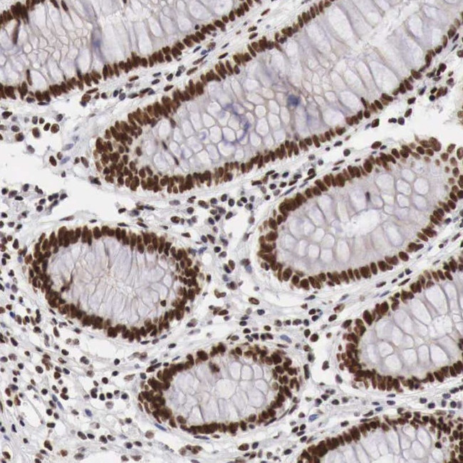 PHF14 Antibody in Immunohistochemistry (Paraffin) (IHC (P))