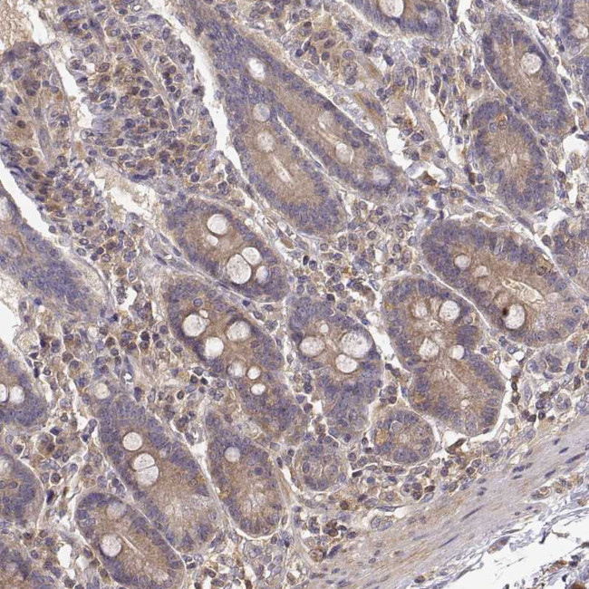 CRIM1 Antibody in Immunohistochemistry (Paraffin) (IHC (P))