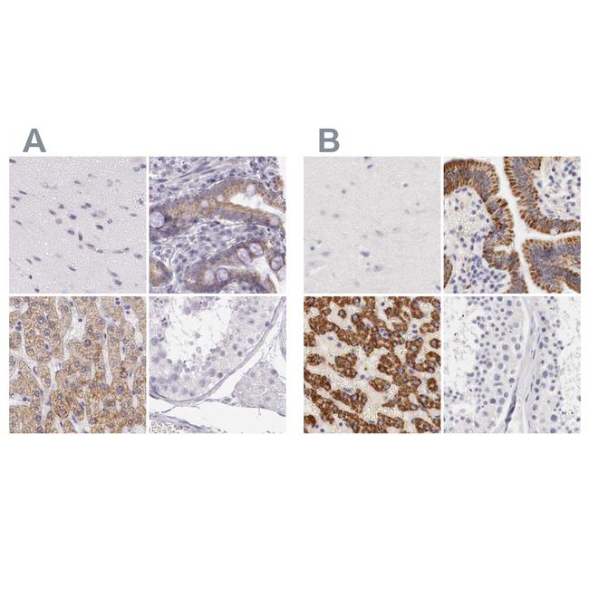 OTC Antibody in Immunohistochemistry (IHC)