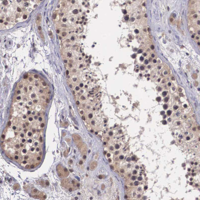 VASH1 Antibody in Immunohistochemistry (Paraffin) (IHC (P))