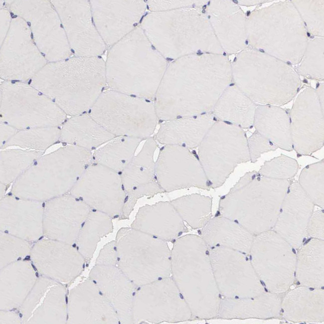 PIRIN Antibody in Immunohistochemistry (Paraffin) (IHC (P))