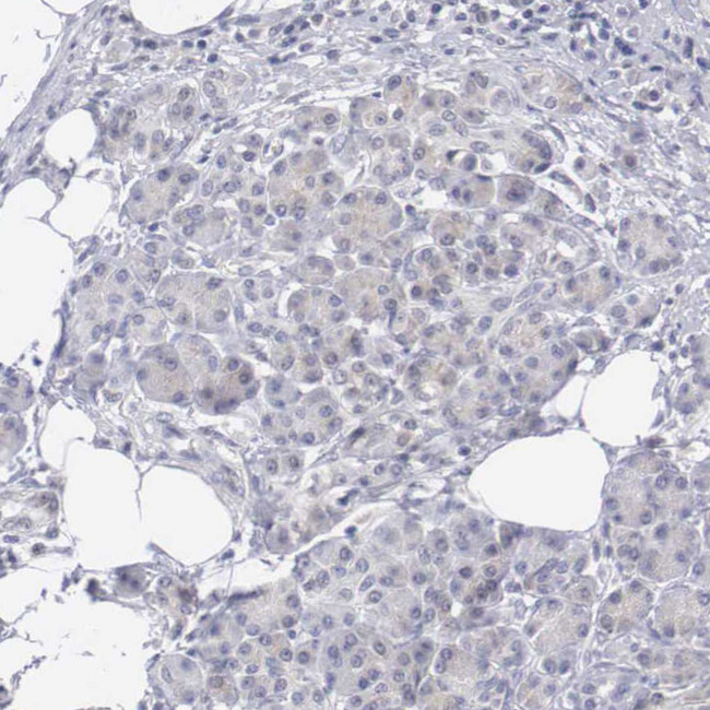 MNAT1 Antibody in Immunohistochemistry (Paraffin) (IHC (P))