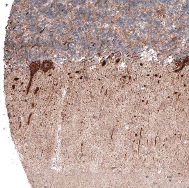 ACOT4 Antibody in Immunohistochemistry (IHC)