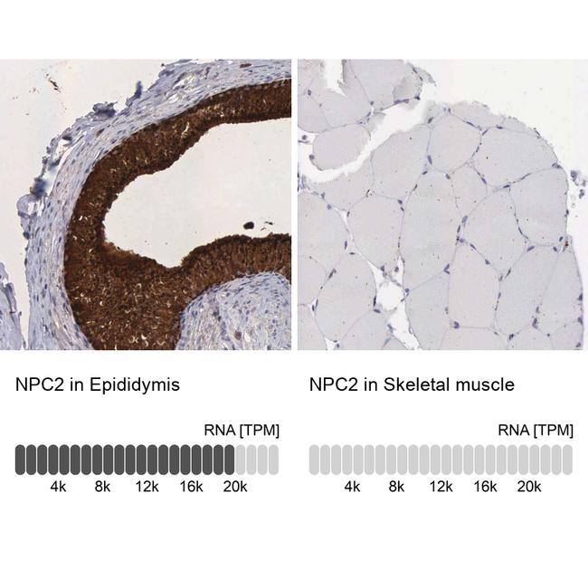 NPC2 Antibody in Immunohistochemistry (IHC)