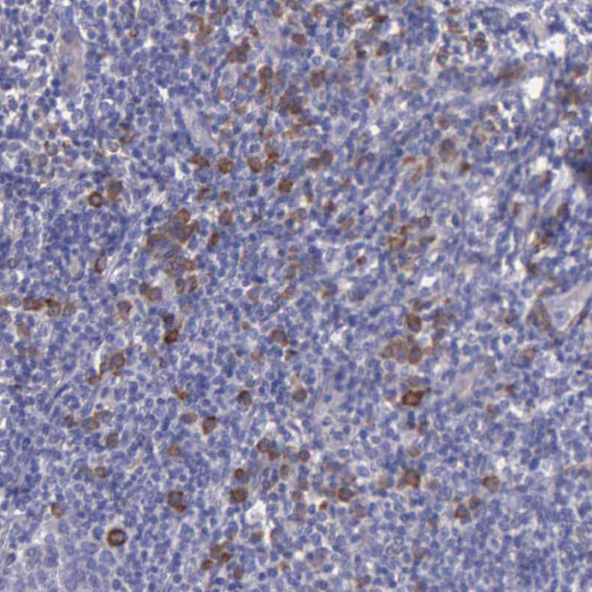 ZC3H12B Antibody in Immunohistochemistry (Paraffin) (IHC (P))