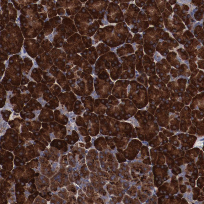 RPS4Y1 Antibody in Immunohistochemistry (Paraffin) (IHC (P))