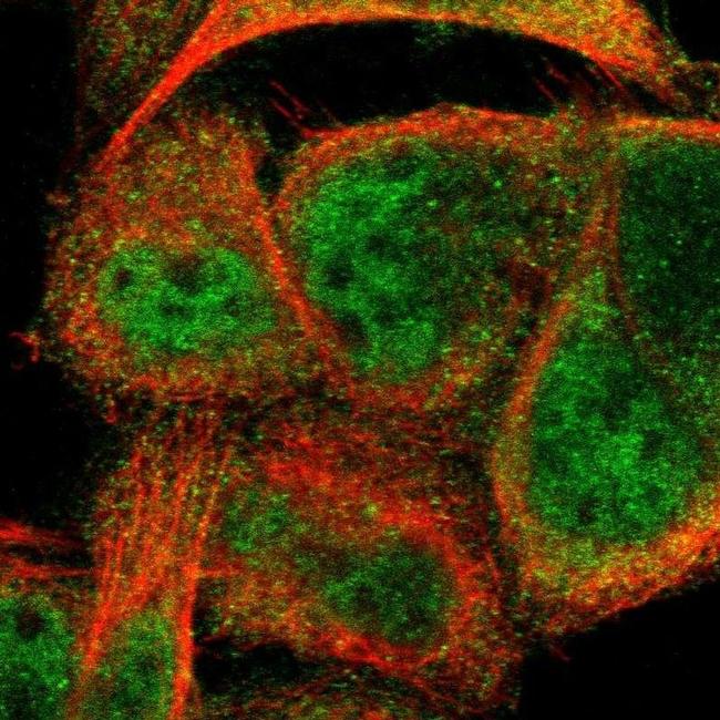 CCDC22 Antibody in Immunocytochemistry (ICC/IF)