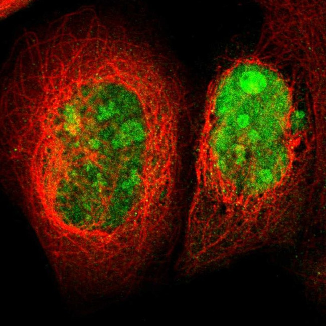 TRMT5 Antibody in Immunocytochemistry (ICC/IF)