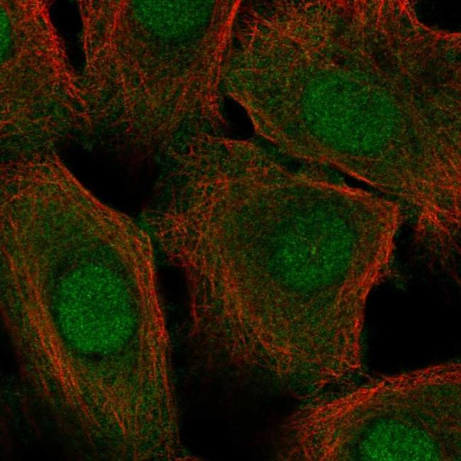 Cystatin A Antibody in Immunocytochemistry (ICC/IF)