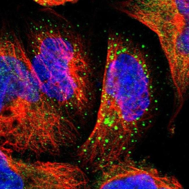 PHKA1 Antibody in Immunocytochemistry (ICC/IF)