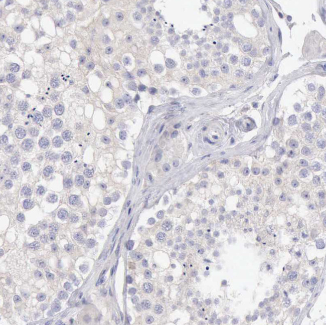 SASH3 Antibody in Immunohistochemistry (Paraffin) (IHC (P))