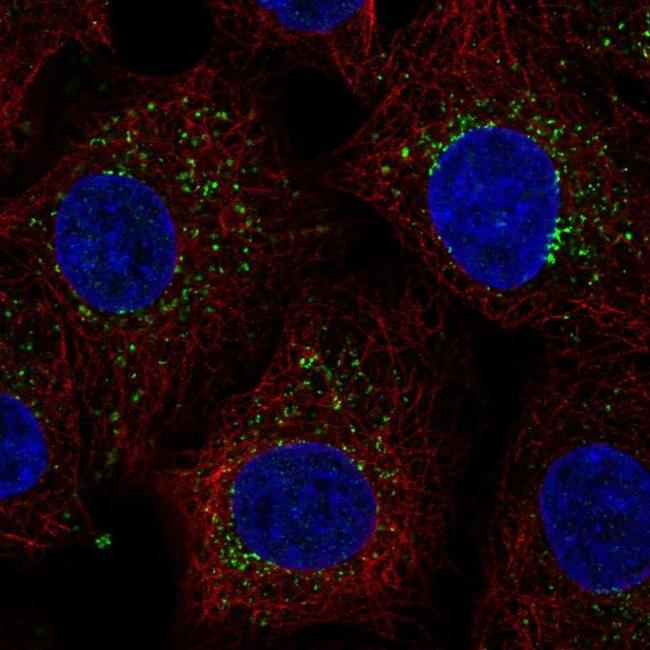 PTGR2 Antibody in Immunocytochemistry (ICC/IF)