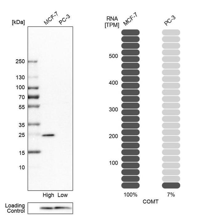 COMT Antibody in Western Blot (WB)