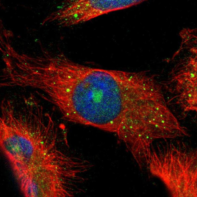 CBS Antibody in Immunocytochemistry (ICC/IF)