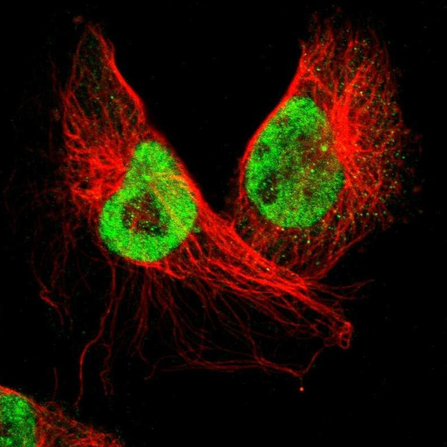 SMEK2 Antibody in Immunocytochemistry (ICC/IF)