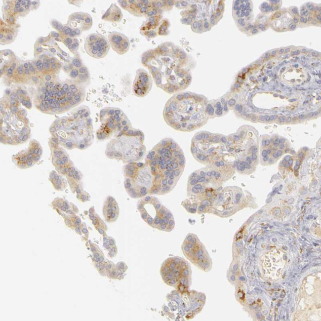 PLOD3 Antibody in Immunohistochemistry (Paraffin) (IHC (P))