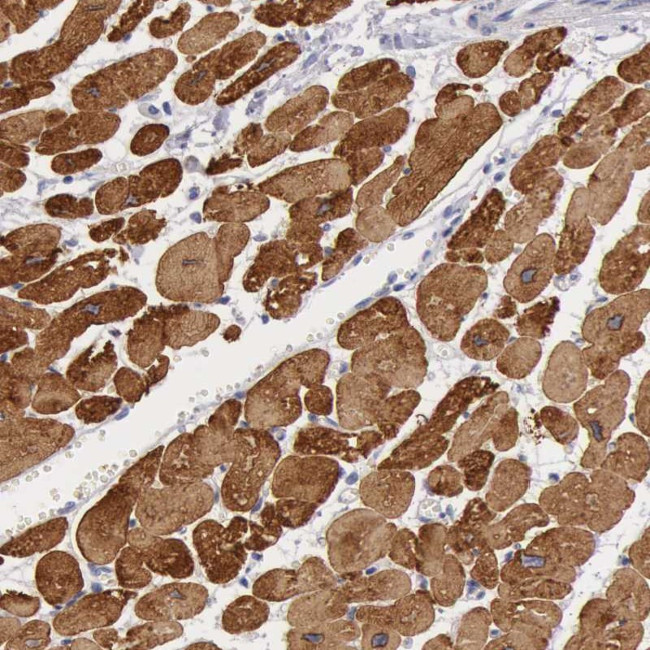 MYH7 Antibody in Immunohistochemistry (Paraffin) (IHC (P))